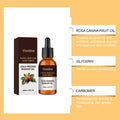 Rose Hip Oil For Caring Skin